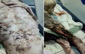 فيديو صادم (18+).. احتجزه لمدة شهر ليأكله، والكلاب أنقذته !
