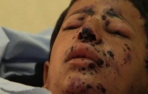 الجيش السعودي يقتل طفلا يمنيا في مديرية رازح الحدودية