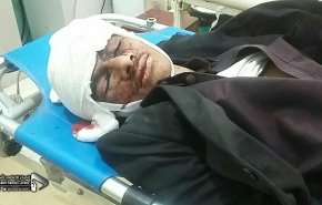 مجزرة تقشعر لها الابدان لقوى العدوان في صعدة+18
