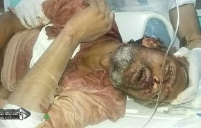 قانونية 'أنصار الله' تتهم واشنطن بجرائم حرب التحالف