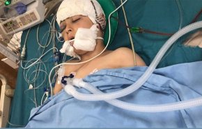 الأمم المتحدة تطالب بالتحقيق في إطلاق الاحتلال النار على الطفل شتيوي