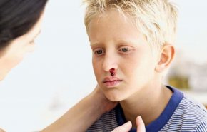 7 أسباب لنزيف الدم من الأنف وهذا علاجها ..