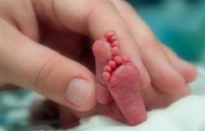 أربعة أرجل وثلاث أذرع... امرأة تنجب طفلة 'خارقة'