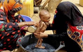 بسبب الحرب 79 % من سكان اليمن يعيشون تحت خط الفقر
