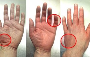 تعرف على طرق قياس ضغط الدم في المنزل و بدون جهاز