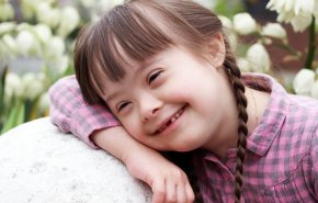 7معلومات مهمة عن متلازمة داون 