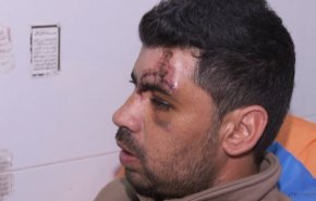 شاهد: مستوطنون يكسرون جمجمة شاب ضفاوي