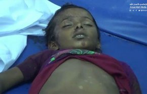 استشهاد 5 أطفال وإصابة سادس بانفجار قذيفة في الحديدة 