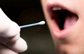 اختبار جديد للكشف عن سرطان الفم عبر اللعاب
