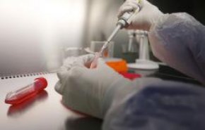 أطباء جزائريون يكشفون نسبة المصابين بالعقم من الرجال