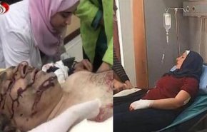 شاهد.. لحظة استهداف طاقم قناة العالم في سوريا