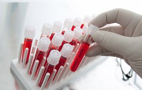  اختبار دم بسيط يمكن أن يقي من 