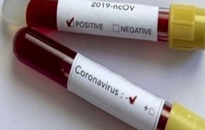 شركة معرفية ايرانية تنجح في تصنيع عدة لتشخيص كورونا