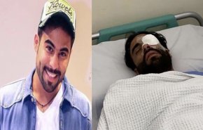 الاعتداء على فنان كويتي بآلات حادة