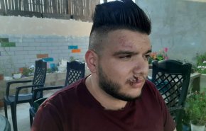 بالصور... مستوطن يطلق كلبه على سائق حافلة مقدسي