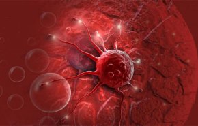 رائحة العرق غير العادية يمكن أن تكون علامة للاصابة بالسرطان 