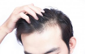 نصائح للتخلص من فراغات الشعر المزعجة بالمواد الطبيعية