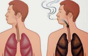 تنظيف الرئتين عند المدخنين بطرق سهلة وطبيعية