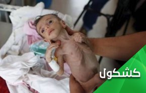 إذا أردت أن تعرف نفاق العالم فانظر الى أطفال اليمن
