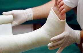 تعرف على الفئة المعرضة لكسور العظام أكثر من الاخرين