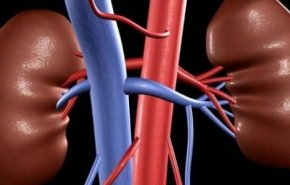 تقرير: 3 مواد غذائية تسبّب تكون الحصى في الكلى
