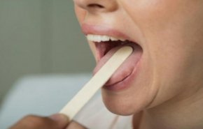 بالصورة .. يمكن اكتشاف اصابتك بكورونا من خلال لسانك