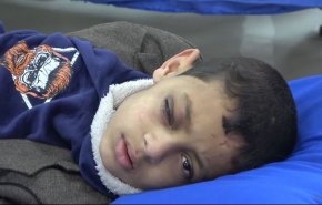 مصير محتوم ينتظر اليمنيون في ظل وقف دعم الصحة العالمية