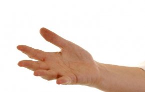 ندب راحة اليد قد تشير إلى مرض قاتل