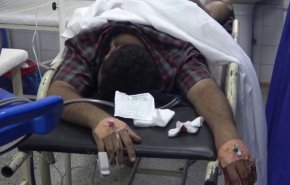 هكذا ينفّذ العدوان الضوء الأخضر الأمريكي لارتكاب مجازره في اليمن  