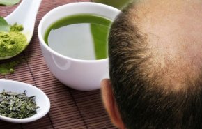 علاج تساقط الشعر.. كيف يمكن للشاي الأخضر أن يمنع الصلع