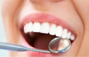 البقع البنية على الأسنان.. هل من طريقة للتخلص منها؟