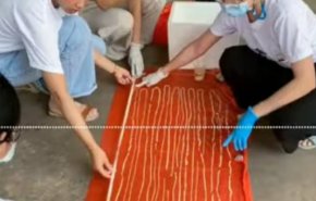 شاهد.. استخراج دودة من أمعاء رجل طولها 18 مترا!
