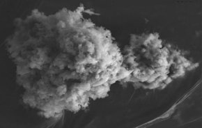 جائحة أخرى تلاحقنا وتقتل 8.7 مليون شخص سنويا.. تعرف عليها!
