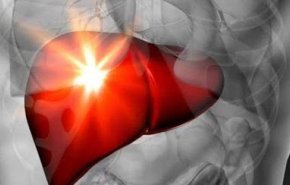 علماء يابانيون يبتكرون علاجاً لتليف الكبد