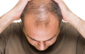 أسباب تساقط الشعر واحسن الطرق لعلاجها
