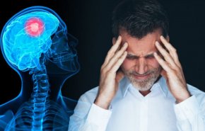 أعراض الصداع.. هل يؤثر على الإشارات الكهربية بالمخ؟