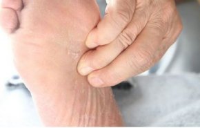 هل تشعر بألم في باطن القدم؟.. إليك الأسباب المحتملة