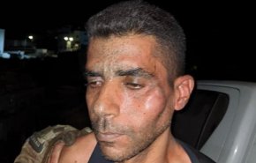 هكذا عنف واعتقل زكريا الزبيدى على يد وحشية الاحتلال