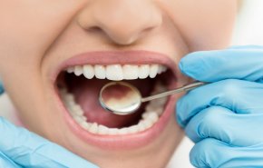 علامتان في الفم تكشفان احتمال الإصابة بمرض السكري