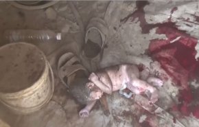 شاهد..مجزرة العدوان الأميركي السعودي في الحديدة