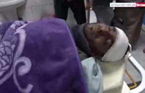 شاهد.. 9 جرحى بغارات همجية على العاصمة صنعاء