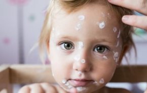 أعراض غير عادية لمتغير أوميكرون لدى الأطفال.. تعرف عليها