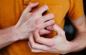 علامات على جلدك تنذر بإصابتك بمتحور أوميكرون