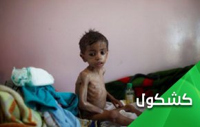 توقع إنقاذ الطفل ريان من البئر.. من ينقذ أطفال اليمن من بئر إبن سلمان وإبن زايد؟