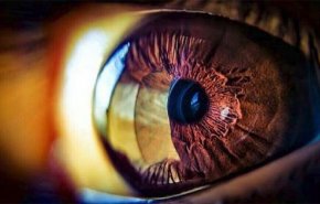 إحذر.. هذه العلامات تشير إلى الإصابة بسرطان العين