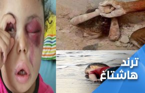 ’لا يمتلكون عيون زرقاء’.. حرب أوكرانيا كشفت النفاق العالمي