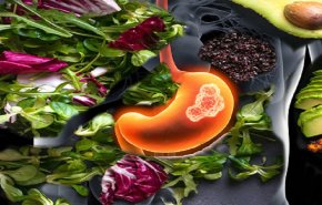 'خضار قاتلة'..ترفع أكلها خطر الإصابة بسرطان المعدة!
