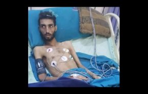 لا أريد أن أموت.. صرخة شاب يمني تعرض لحقنة قاتلة في السعودية!