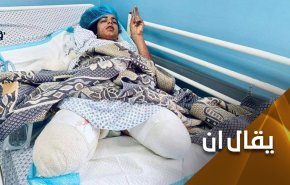 امريكا 'راعية حقوق الانسان'.. تندد باصابة حلفائها وتتعامى عن تقطع اشلاء الآخرين!