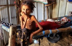 الأمم المتحدة: معدلات الجوع ارتفعت 10 أضعاف في اليمن